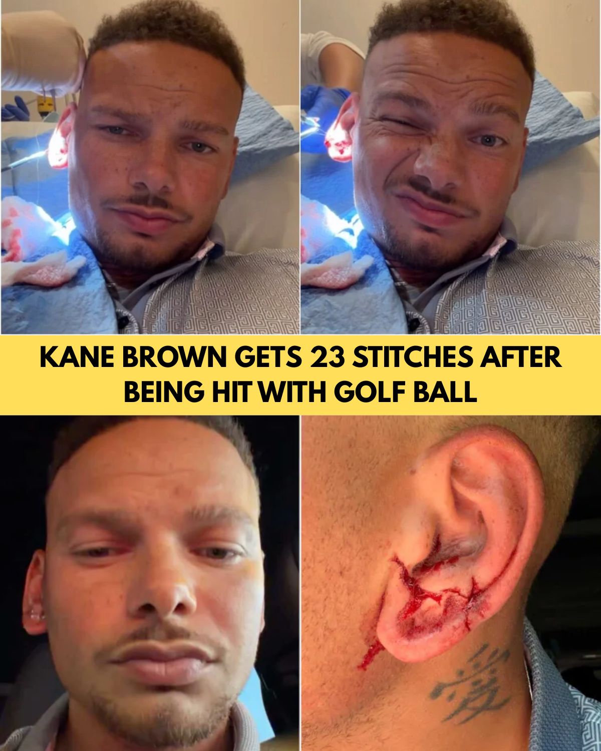 Kane Brown Gets Hit in the Head by a Golf Ball During Charity Event — And Somehow Keeps Smiling