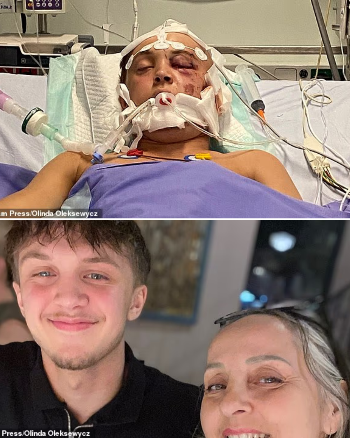 British Teen Left in Coma with Severe Brain Injuries on First Holiday Without Family in Zante — Now His Mother Is Begging for Help After Learning He Was Uninsured