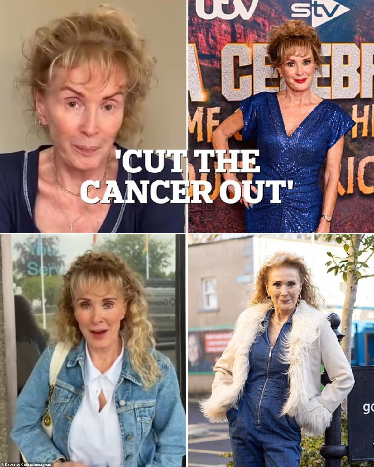 Beverley Callard, 69, says she's 'nervous and on edge' as she returns to work after being treated for breast cancer