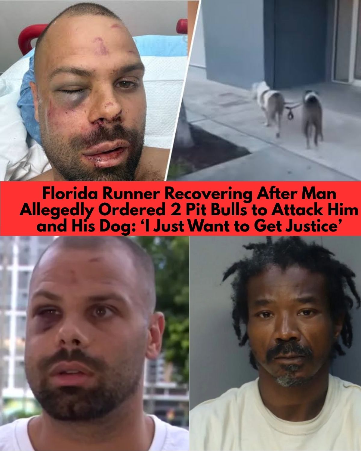 Miami Runner Recovering After Alleged Pit Bull Attack Leaves Him and His Dog Seriously Injured