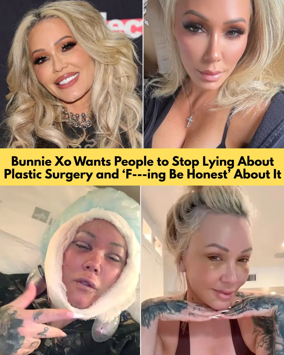 Bunnie Xo Says People Need to Stop Lying About Plastic Surgery: “Be Honest” About It