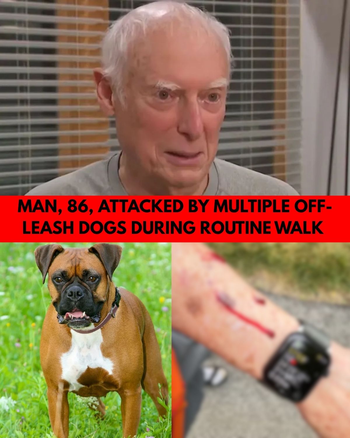 “My Worst Nightmare”: 86-Year-Old Man Mauled by Three Off-Leash Dogs During Morning Walk as Owners Allegedly Flee the Scene